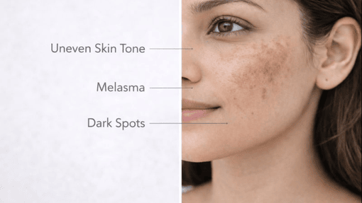 Best Pigmentation Clinic in Anjanapura, Bangalore