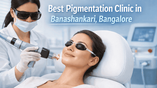 Best Pigmentation Clinic in Banashankari