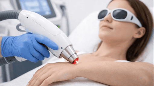 Laser Hair Removal in Uttarahalli, Bangalore